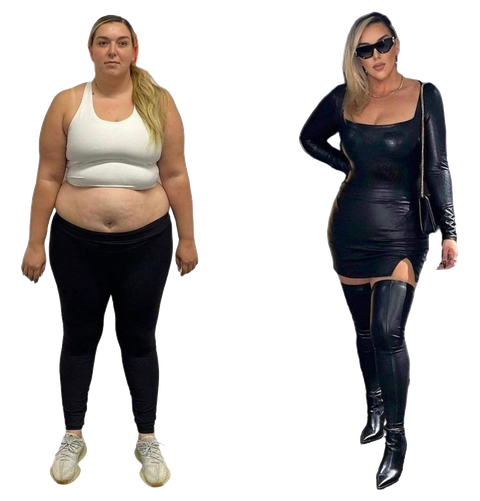 Elite Technique before-and-after photographs, client progress 6