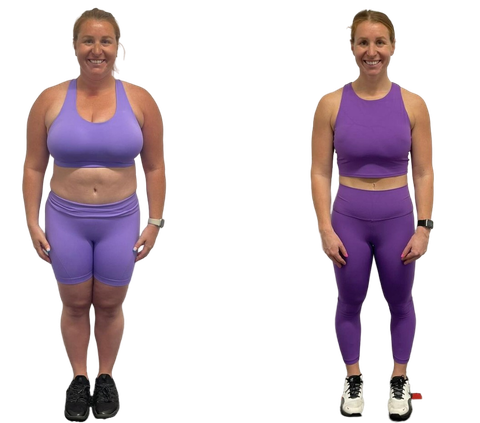 Elite Technique before-and-after photographs, client progress 4