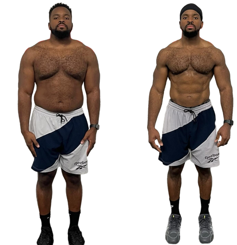Elite Technique before-and-after photographs, client progress 5