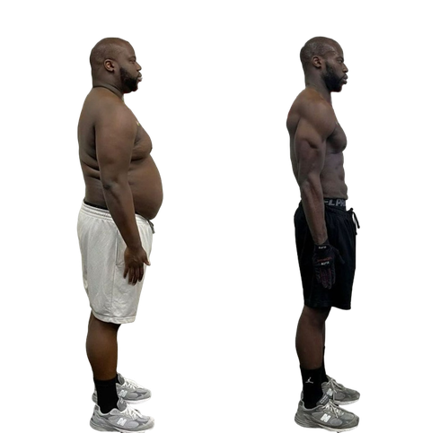 Elite Technique before-and-after photographs, client progress 2